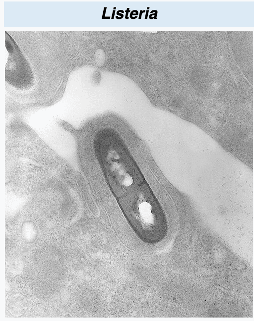 Listeria (microscoop)